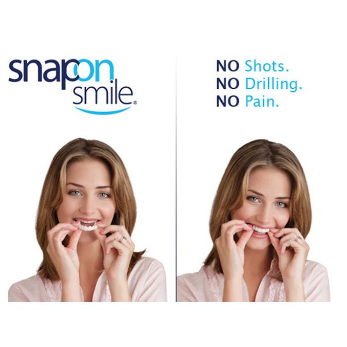 Răng Giả Snapon Smile Kmdeal
