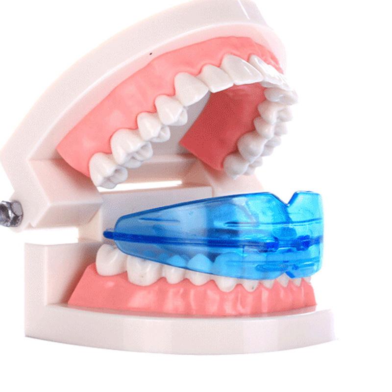 Dụng cụ niềng răng tại nhà