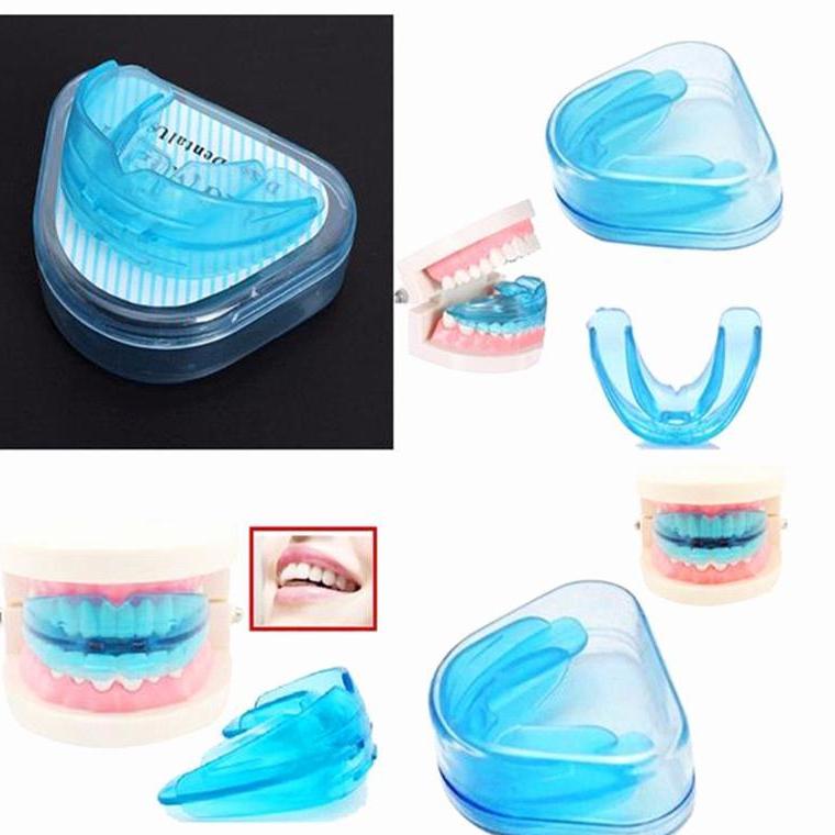 Dụng cụ niềng răng tại nhà
