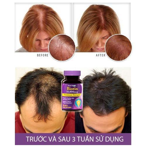 THUỐC MỌC TÓC DƯỠNG MÓNG NATROL BIOTIN 10000 MCG