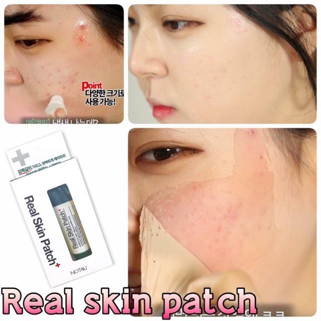 Gel vá da che mụn, sẹo thần thánh Not4U Real Skin Patch