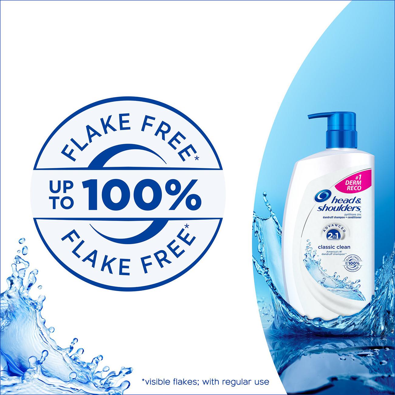 Dầu gội trị gàu Head & Shoulders Classic Clean 950ml