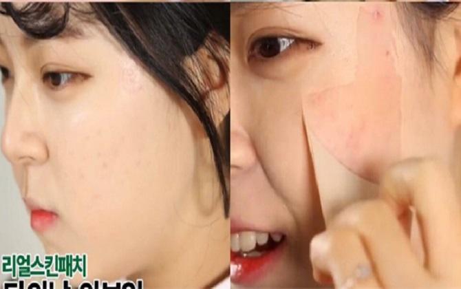 Gel vá da che mụn, sẹo thần thánh Not4U Real Skin Patch