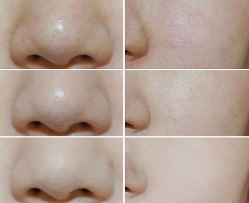 Phấn phủ Baby Powder Pressed Nhật Bản 50gr
