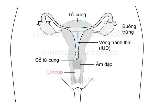 Combo 2 Cốc nguyệt san Vivacup size S + L