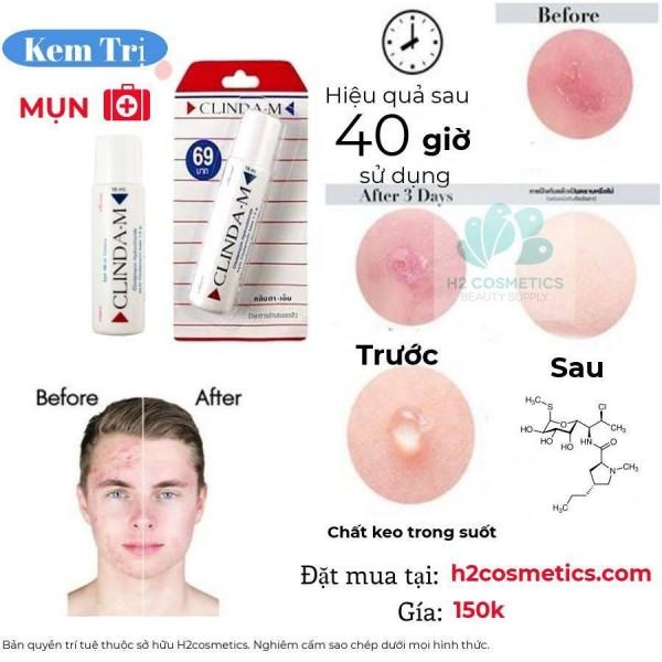 Thuốc chấm mụn Clinda-M - 15ml