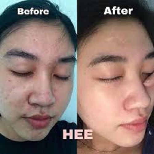 THAY DA TÁI TẠO ANGEl 50ML