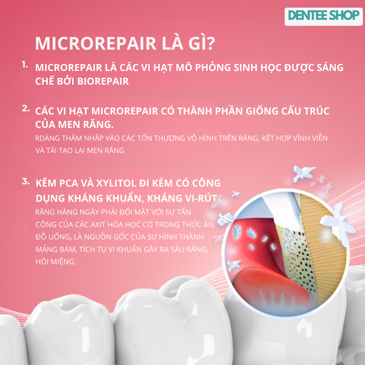 Kem đánh răng cho răng nhạy cảm Biorepair Sensitive 75ml