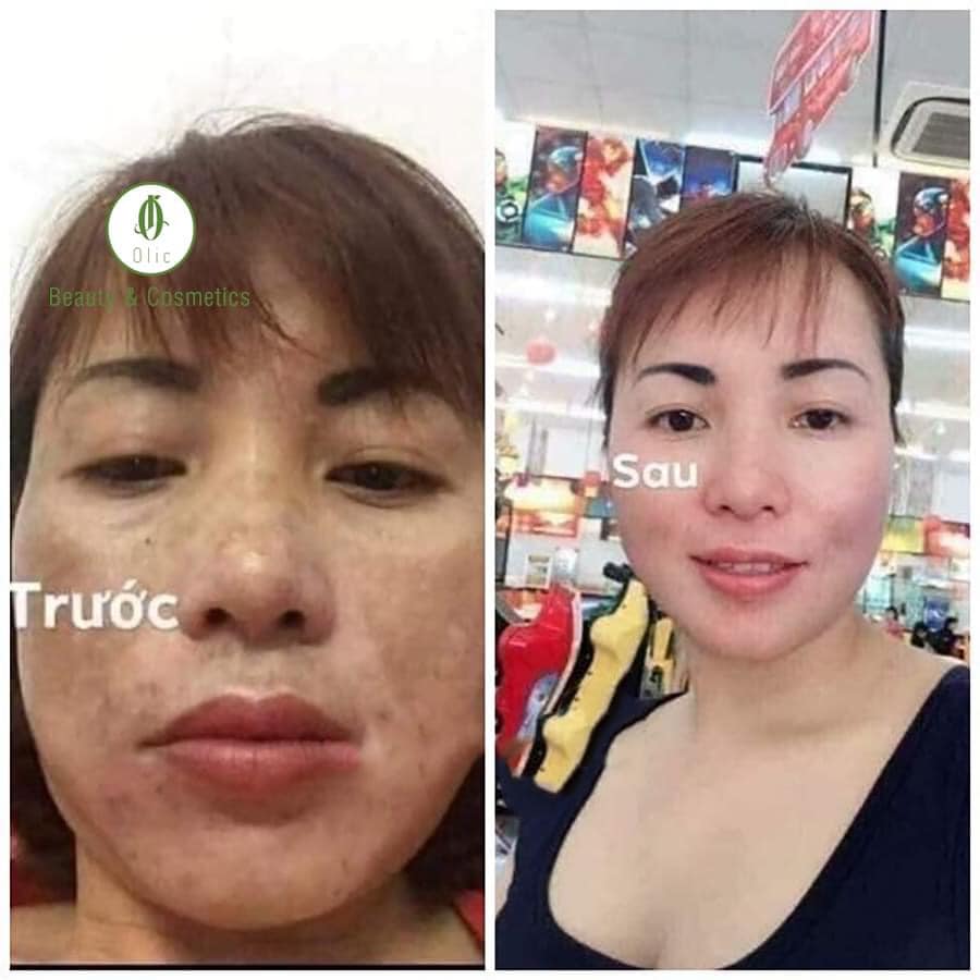 Combo sỉ 3 Kem Bơ Olic chính hãng