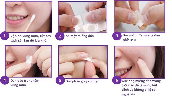 MIẾNG DÁN MỤN MAYAN CARE  ( HỘP/20 MIẾNG)