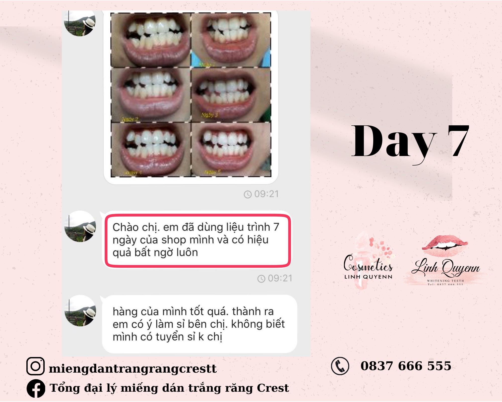 Miếng Dán Trắng Răng Crest 3D White Sensitive mẫu mới (Gentle Doux Whitestrips) - FULLBOX - CHO RĂNG NH