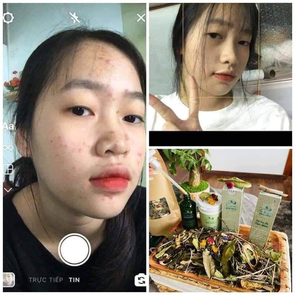 ĐÔNG Y HẠNH SINOO