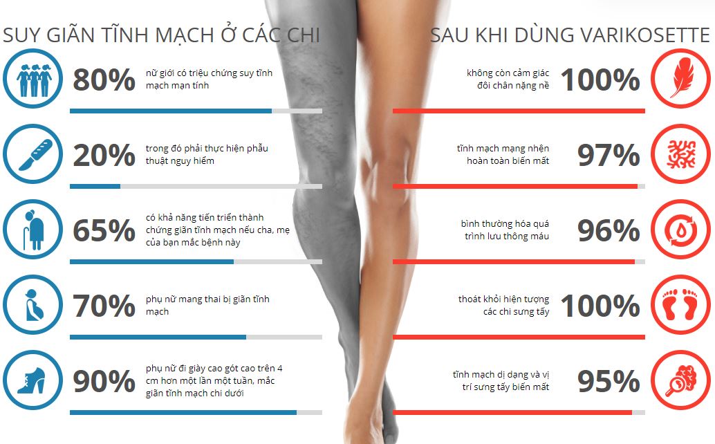 Combo 5 Hộp Kem Cho Giãn Tĩnh Mạch Varikosette Nga