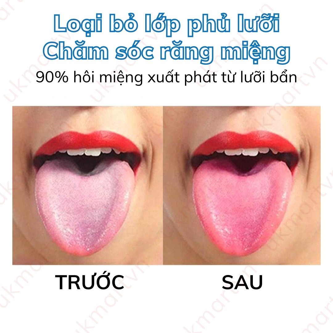 Dụng Cụ Vệ Sinh Cạo Lưỡi Pierrot 1 Cây