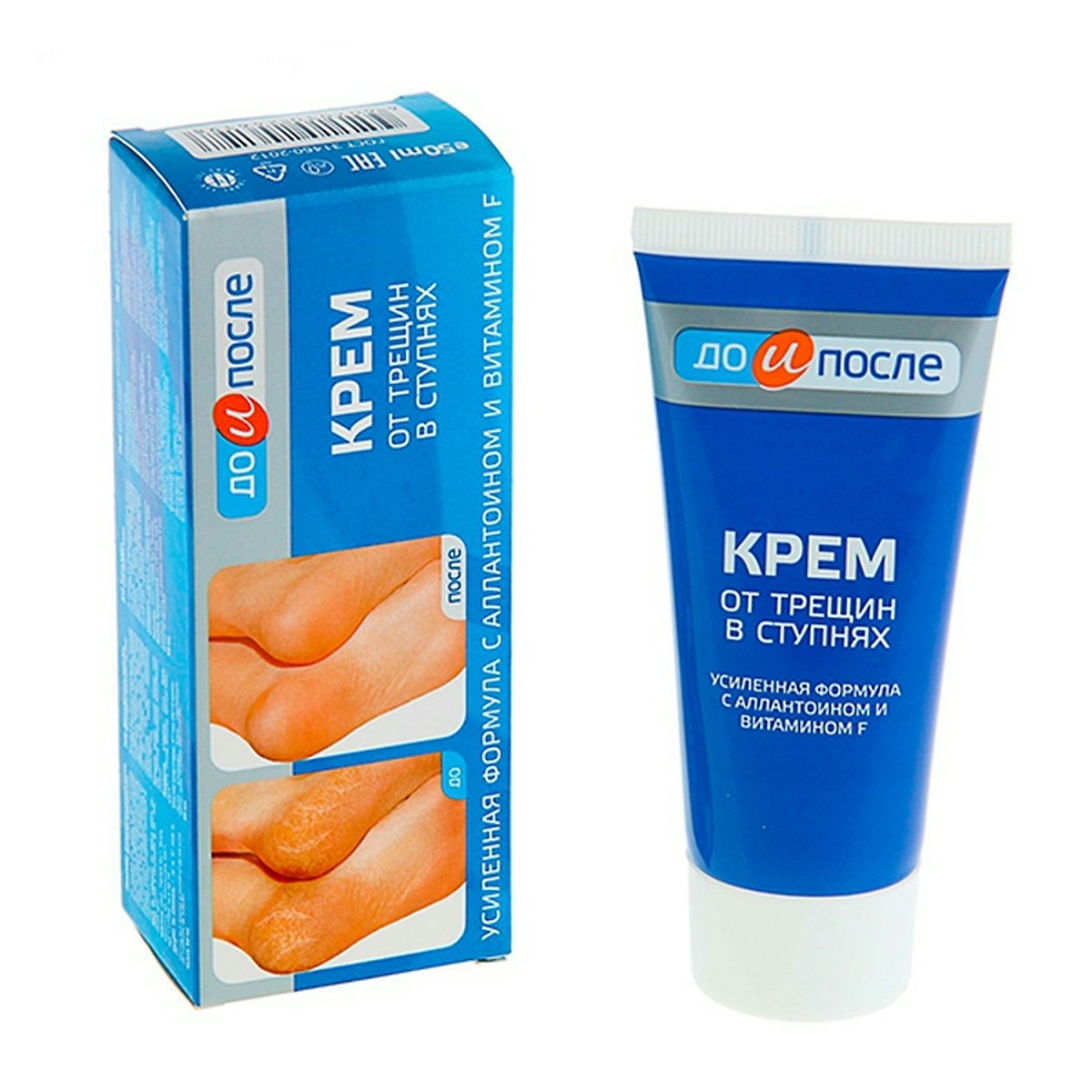 [HCM]Kem Trị Nứt Gót Chân Hàng Nga