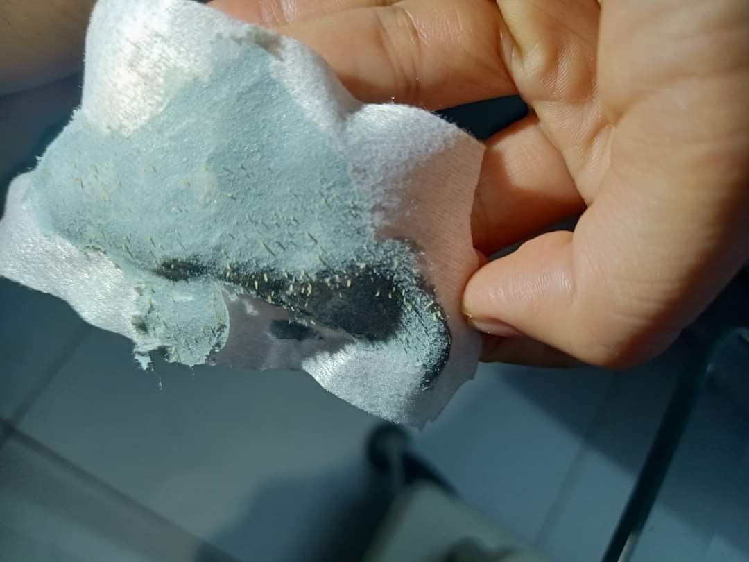 Bộ sản phẩm sạch mụn và dưỡng da (noãn thực vật +gel lột)