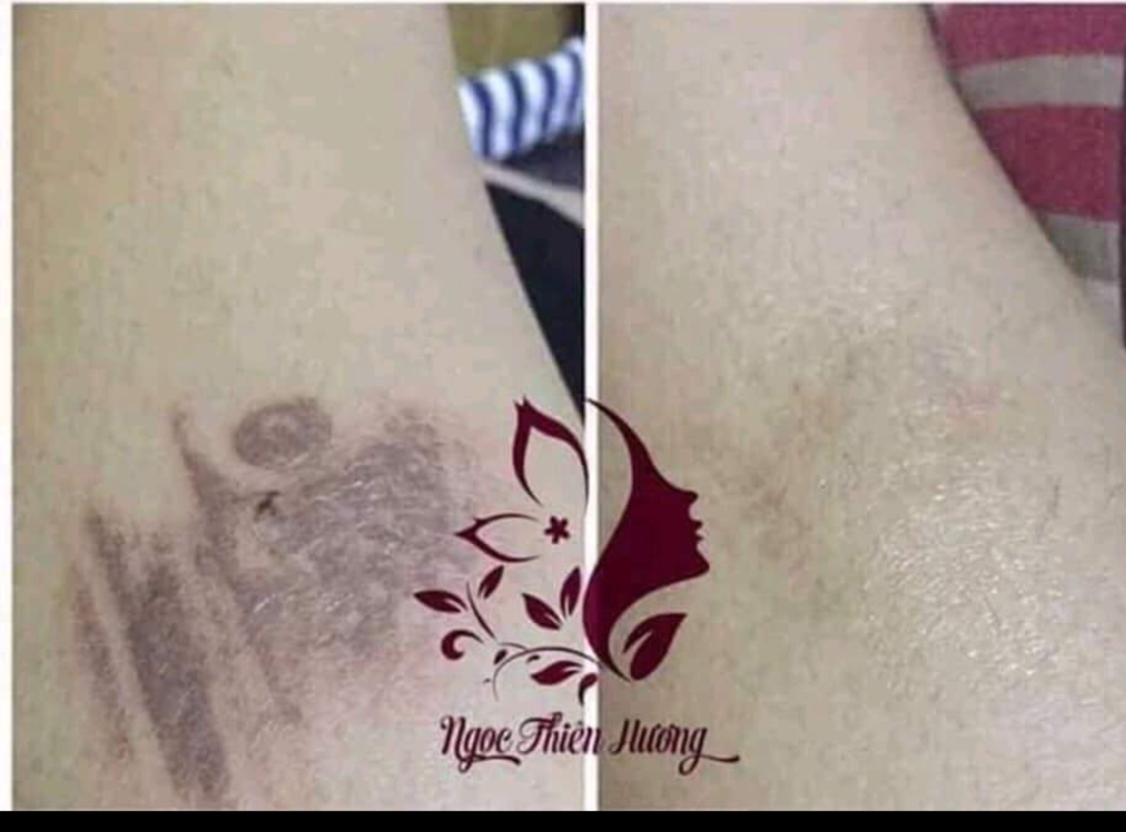 Serum tri thâm Ngọc Thiên Hương