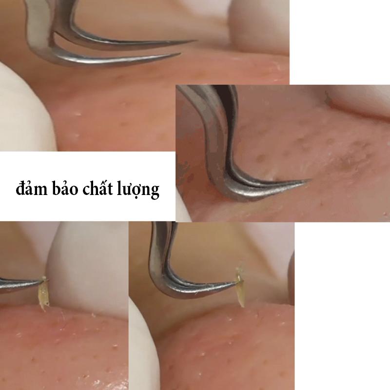 Nhíp gắp Mụn đầu cong Hàng Thái Lan đúng chất lượng