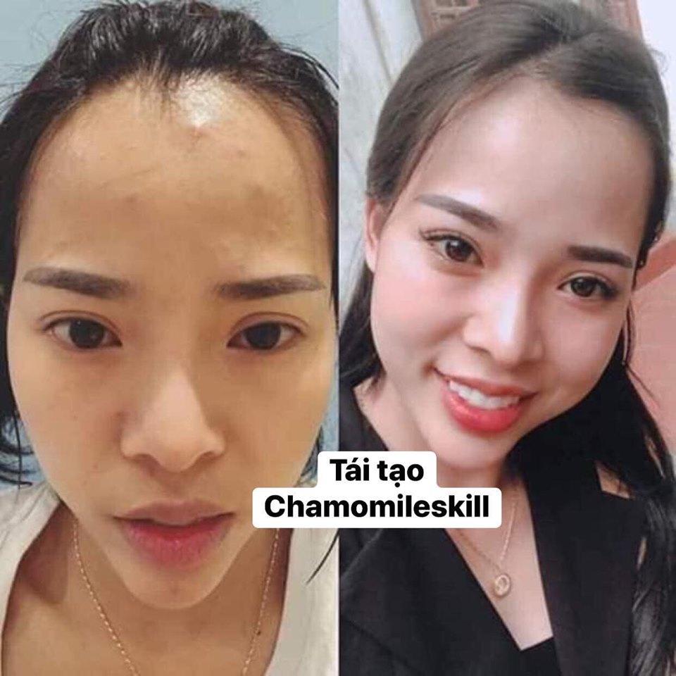 [HCM]Kem tái tạo Chamomileskill