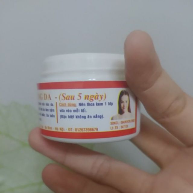 Kem Tigon dưỡng trắng da
