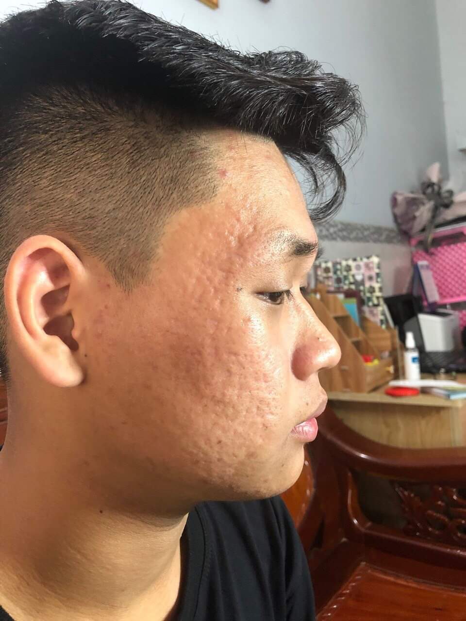 Bột Thảo Dược Rữa Mặt Phương Anh