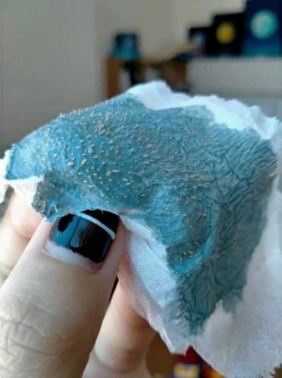 Gel hút mụn Olap - Gel lột mụn