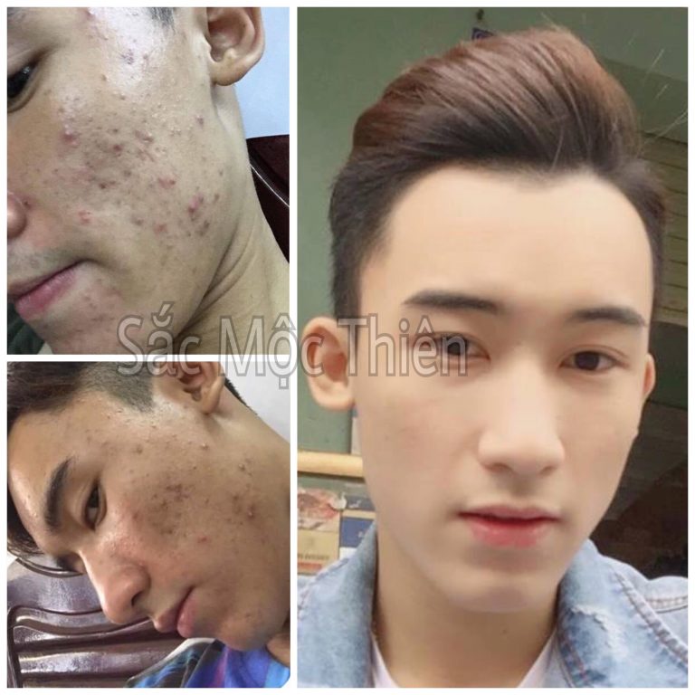 [HCM]Bộ Combo Sắc Mộc Thiên Linh Chi Bột Bạch Thiên Thảo