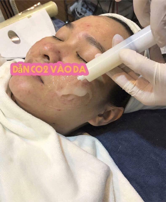 [HCM][Chính hãng Spa] MẶT NẠ THẢI ĐỘC TRỊ MỤN DJ CARBON THERAPY