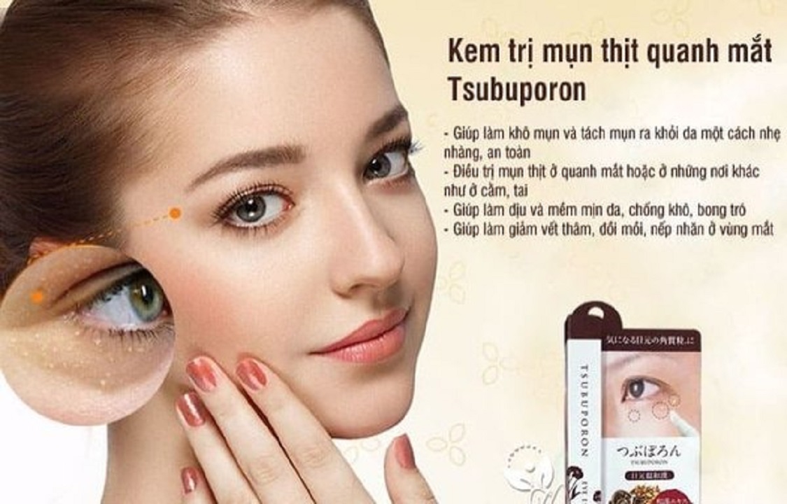 Kem xóa mụn thịt mụn gạo Tsubuporon Nhật Bản