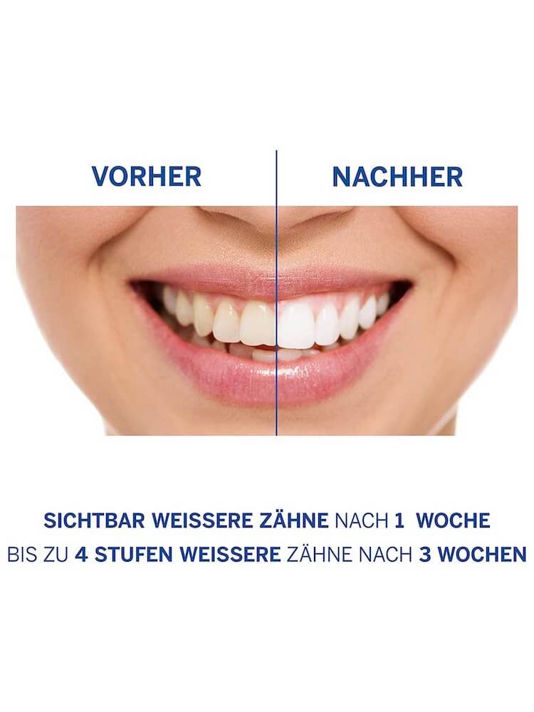 Kem Đánh Siêu Trắng Răng Perl Weiss Expert Weiss 50ml