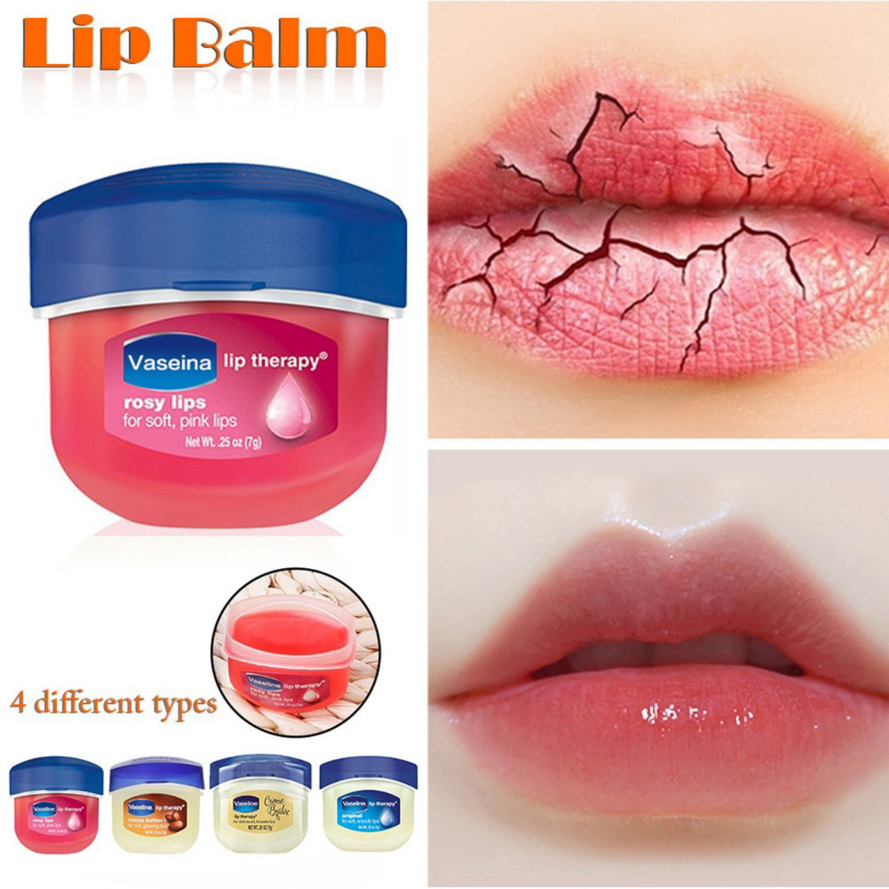 Son dưỡng Vaseline Lip Therapy 7g