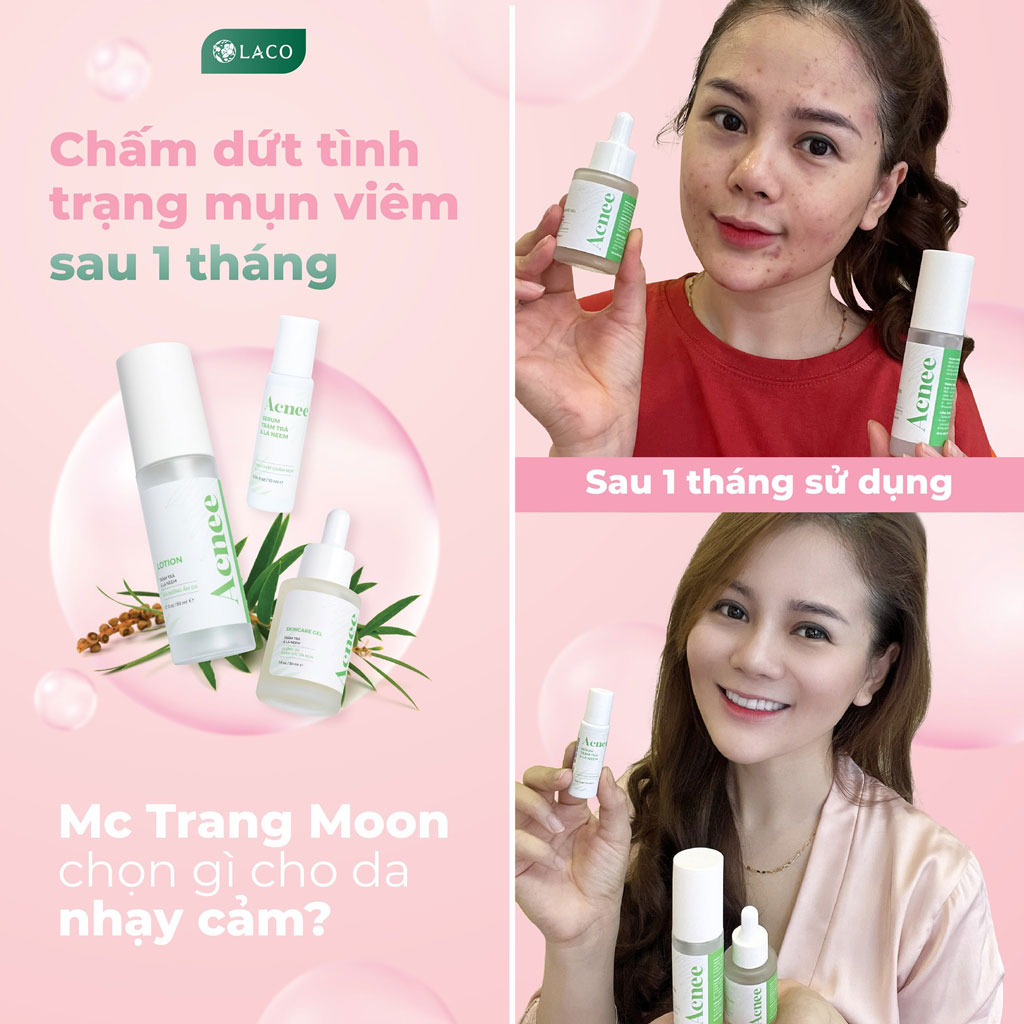Tinh chất chấm mụn Laco Acnee - Serum Tràm trà
