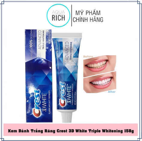 KEM ĐÁNH RĂNG 3D CREST WHITE TRẮNG RĂNG 158G (99g - 147g - 153g - 158g - 170g)