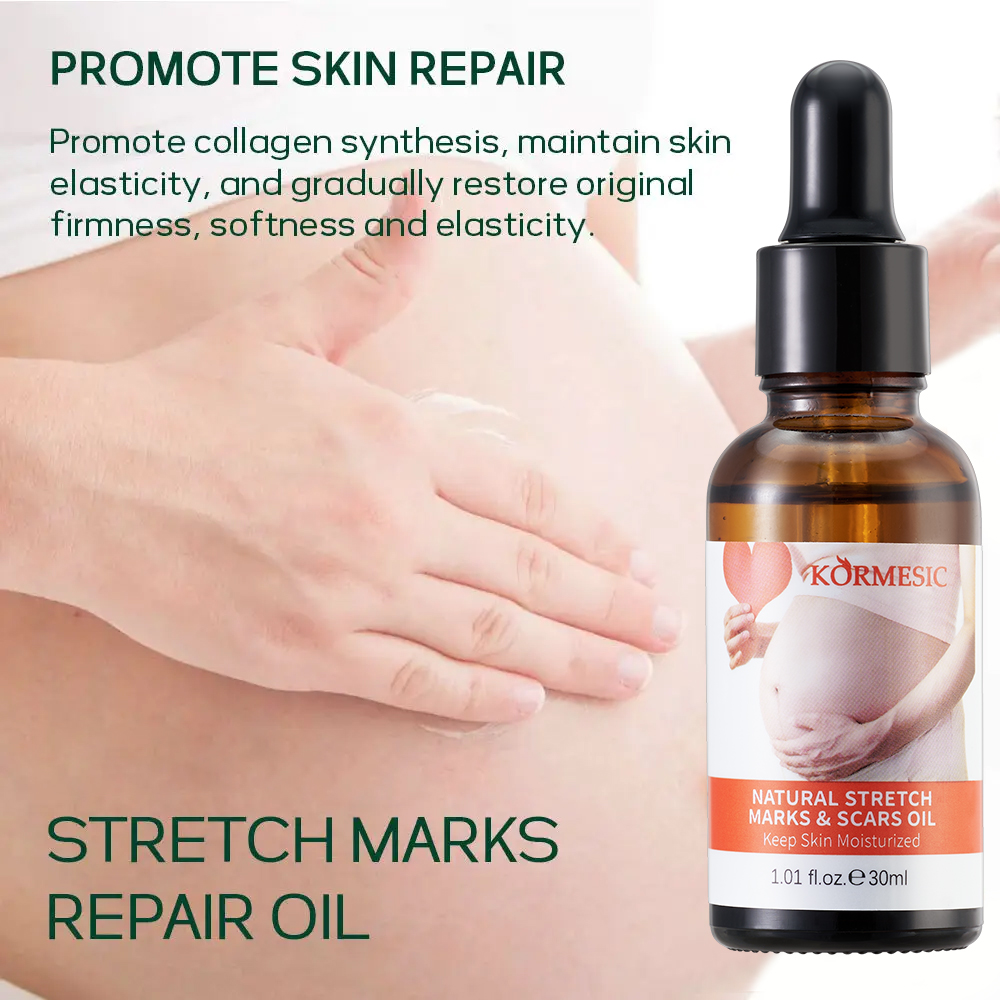 Tinh dầu trị rạn da KORMESIC 30ml