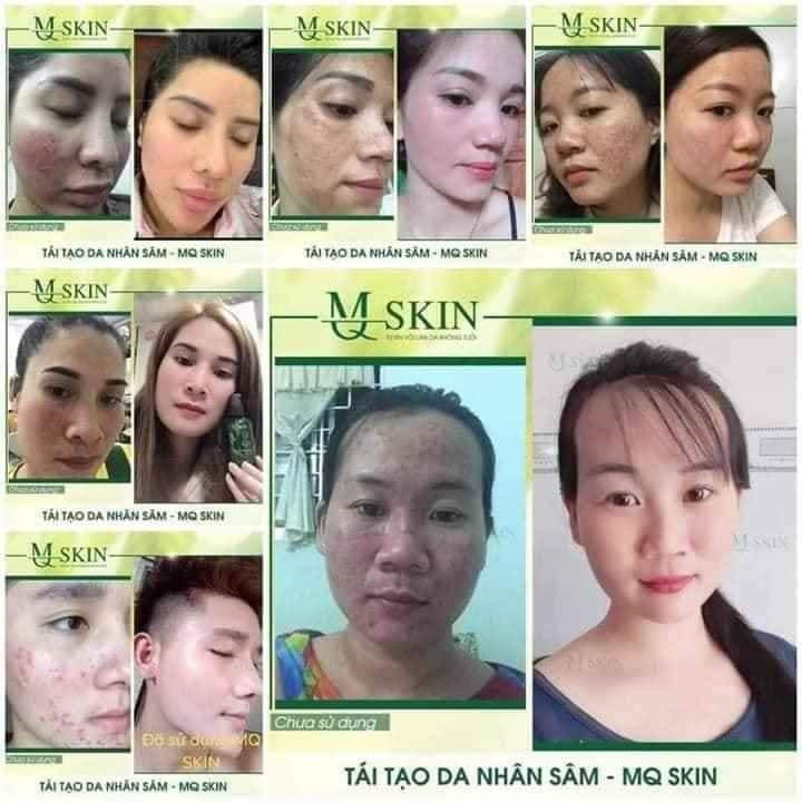 KEM TÁI TẠO DA NHÂN SÂM MQSKIN (Gingseng Repair Serum)