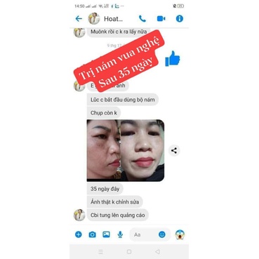 [FREESHIP 50K] Vua Nám nghệ Collagen (kem ngày)  Hoàng Ngọc Diệp