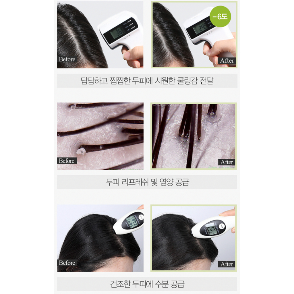 [TẶNG KÈM QUÀ] Dầu gội & Xịt dưỡng giảm rụng tóc DALEAF Better Root Line