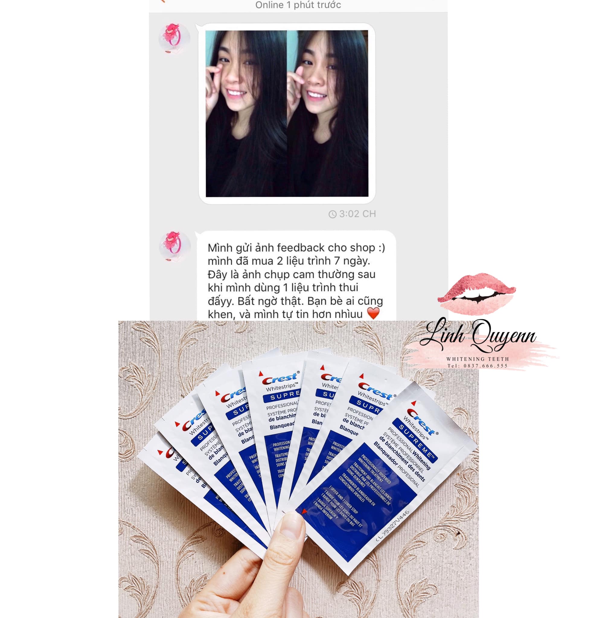 MIẾNG DÁN TRẮNG RĂNG Crest Supreme Professional