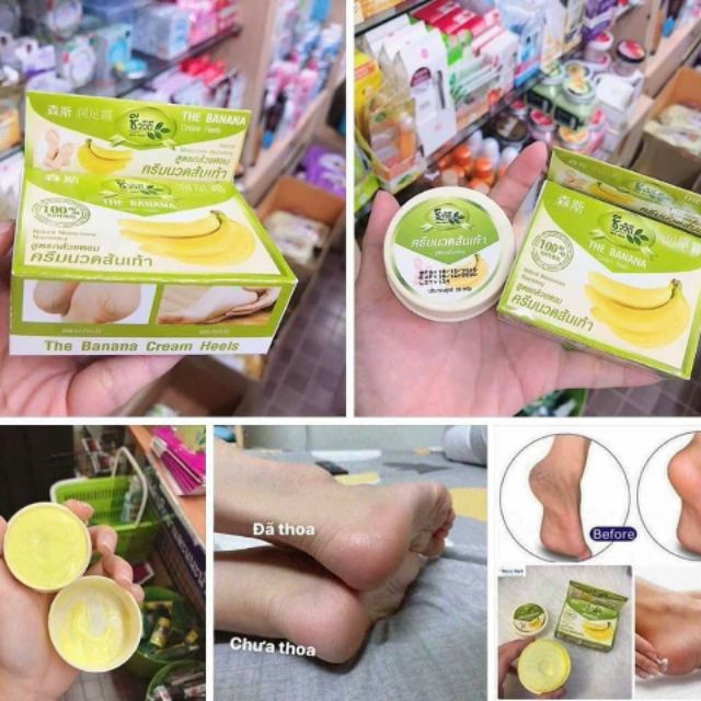 Kem Xóa Nứt Gót Chân Chuối Banana Thái Lan Chính hãng