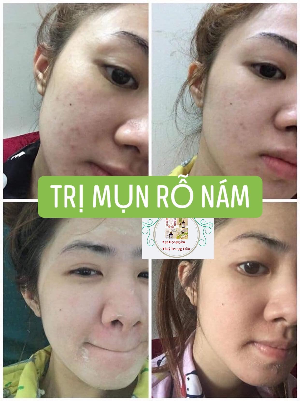 Tái Tạo Da (50ml).
