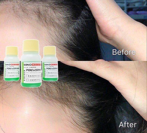 [Mẫu mới] Tinh chất mọc tóc giảm rụng Sato Nhật Bản 30ml