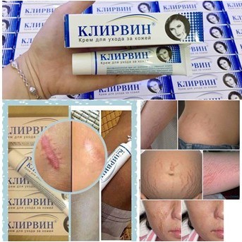 (Combo 5 Tuýp) Kem Mờ Sẹo Nga , Rạn Da Klirvin 25g Sẹo Lỗm , Sẹo Rỗ Và Vết Thâm Hiệu Quả