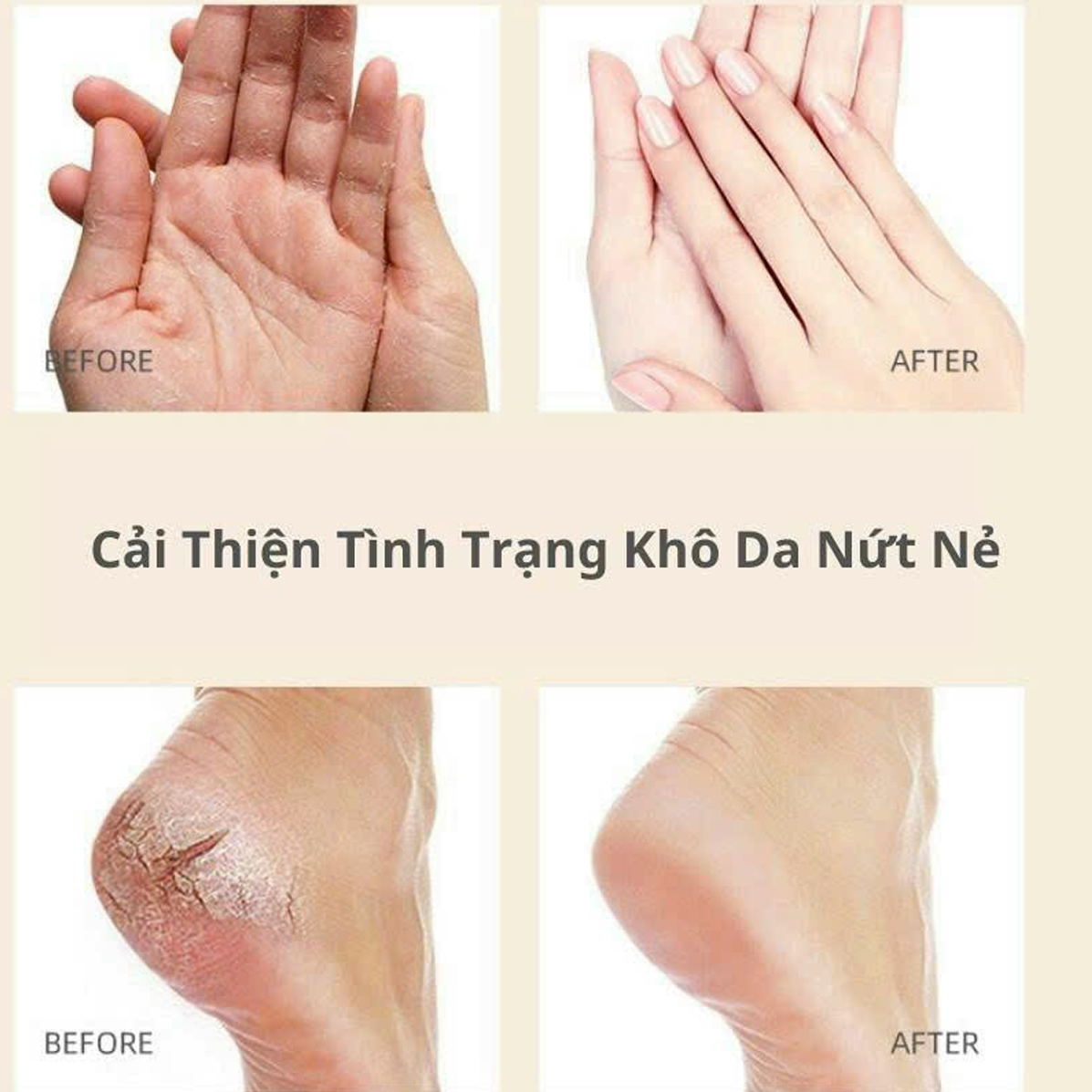 Kem Trị Nứt Gót HEYXI