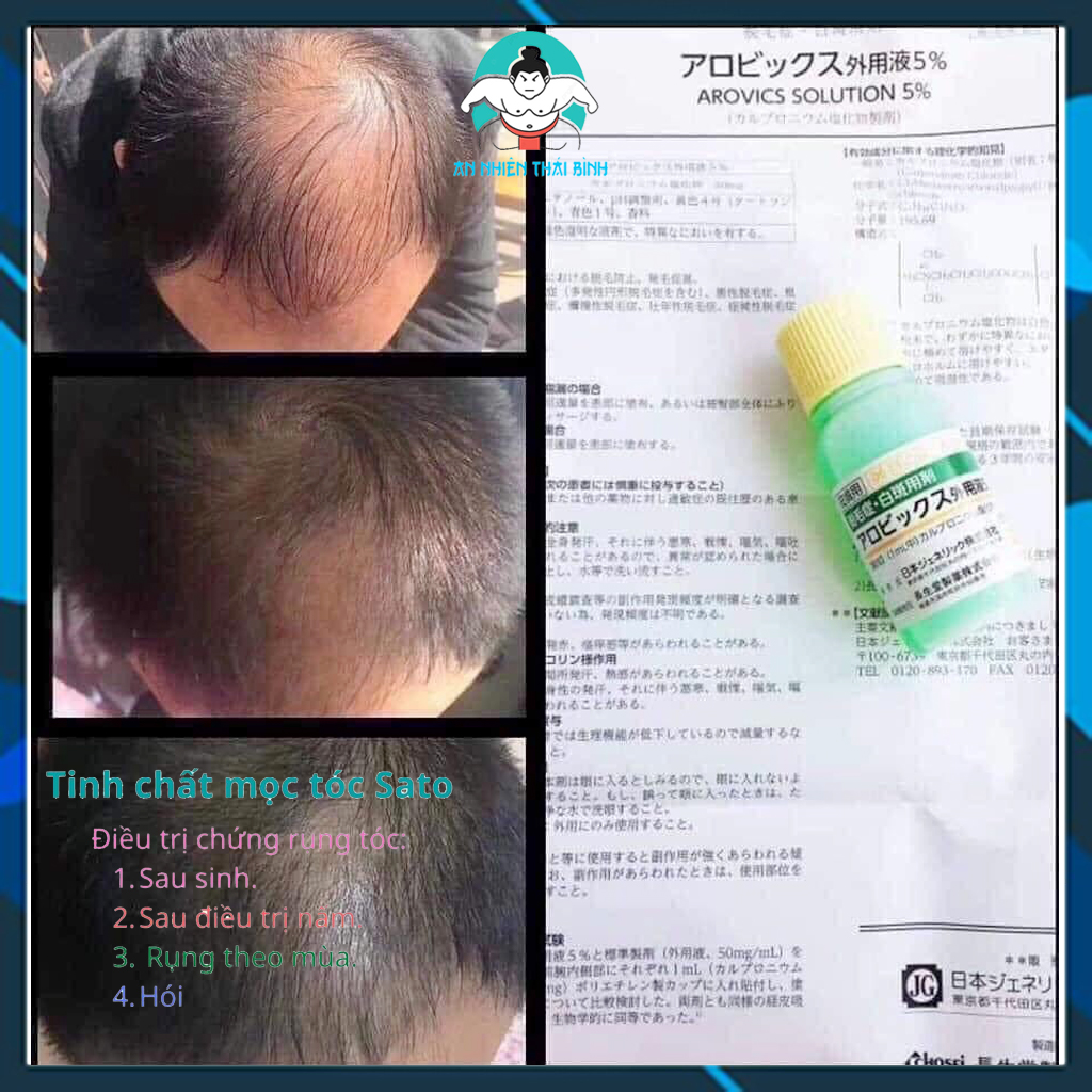 Tinh chất mọc tóc Sato Nhật Bản 30ml