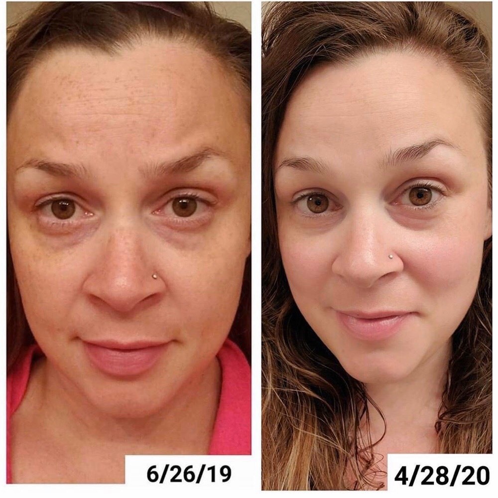 Bột Uống Collagen lựu đỏ bio cell VIKO Korea