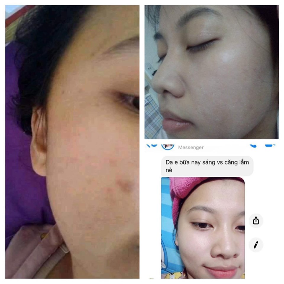 [HCM]KEM TÁI TẠO CHAMOMILESKILL