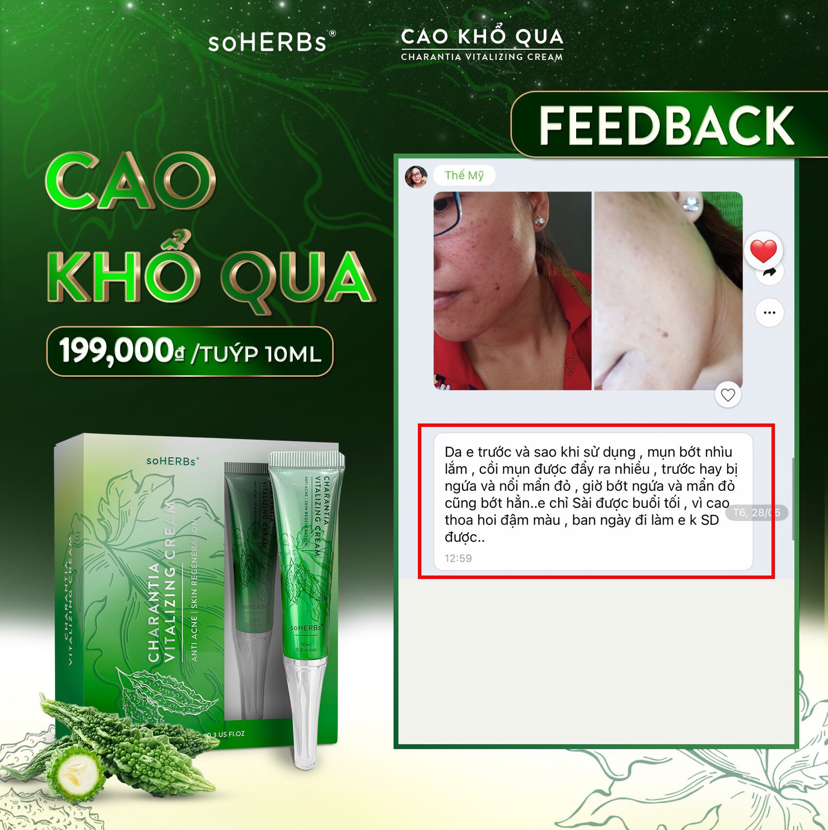 [HCM]CAO KHỔ QUA SOHERBS Da Mụn Trắng Da Mờ Thâm 10ml