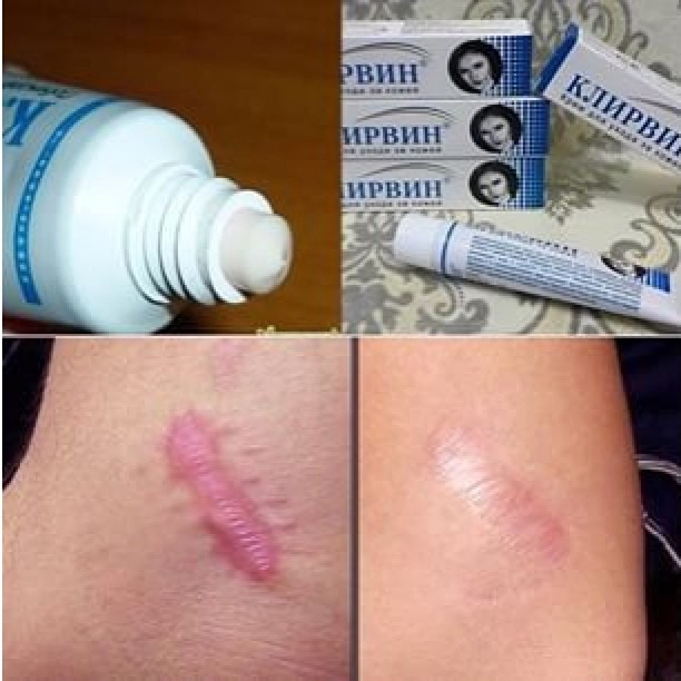 Kem làm giảm sẹo, thâm đen KLIRVIN 25g