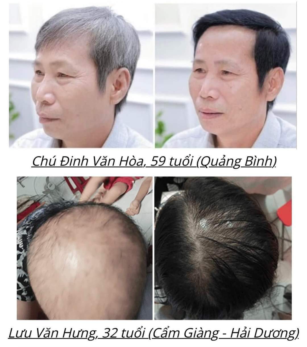 Dầu gội phủ bạc gói Akami phủ bạc tóc (25ml/75ml/105ml) - NÂU ĐEN