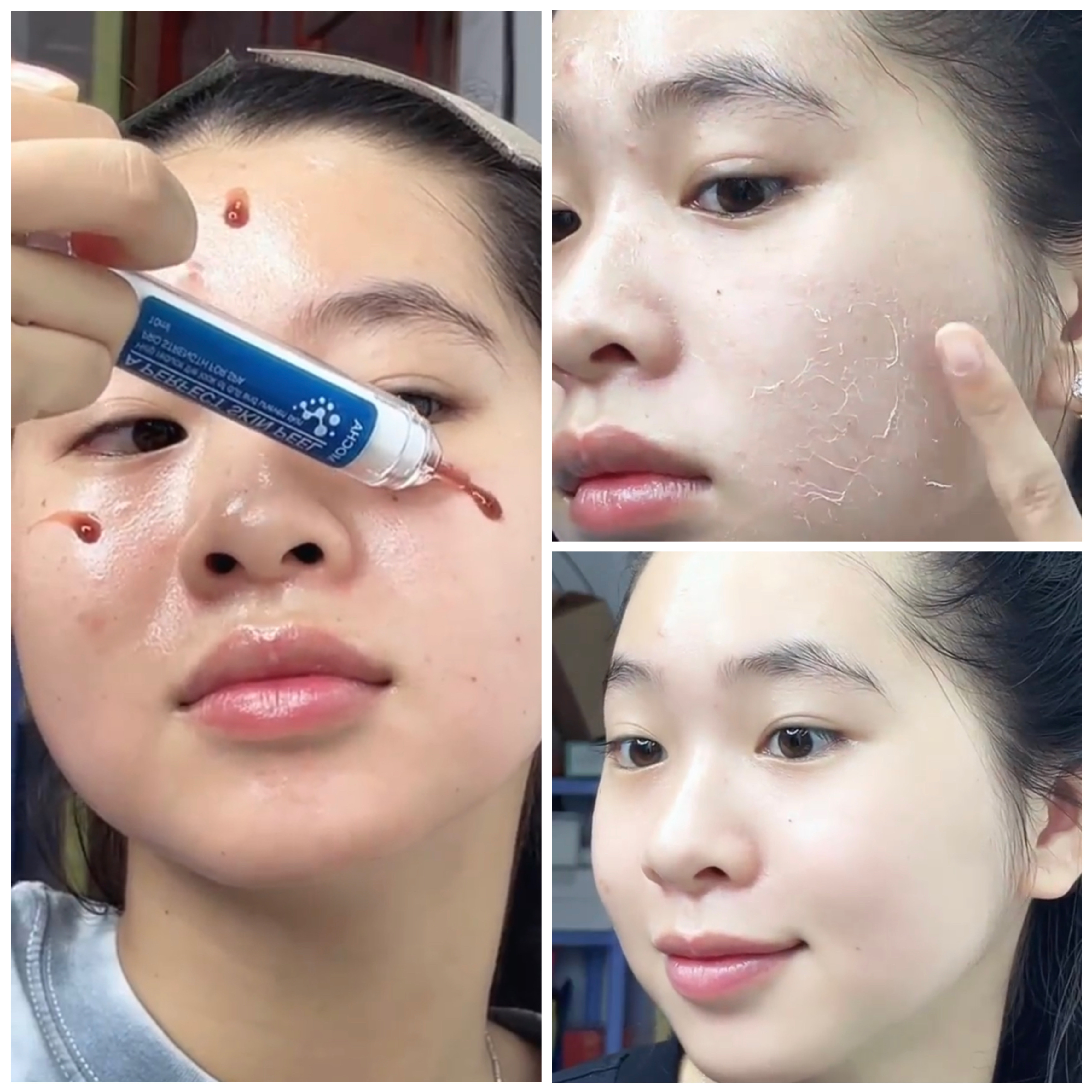 Peel da Mocha Retinol MUA 1 được 5 sản phẩm